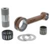 HDS Connecting Rod Kit